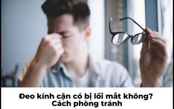 Đeo kính cận có bị lồi mắt không? Cách phòng tránh